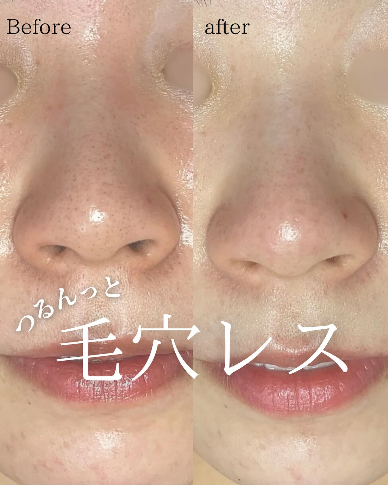 化粧で隠すのやめませんか✨