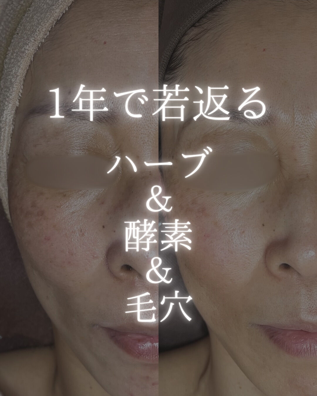 1年でここまで変わる！若返りビフォーアフター