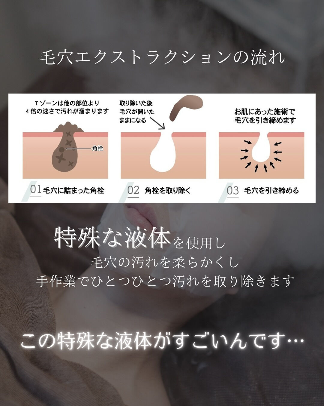 【福岡市】まるで別人級！黒ずみ毛穴が劇的にキレイになる理由！