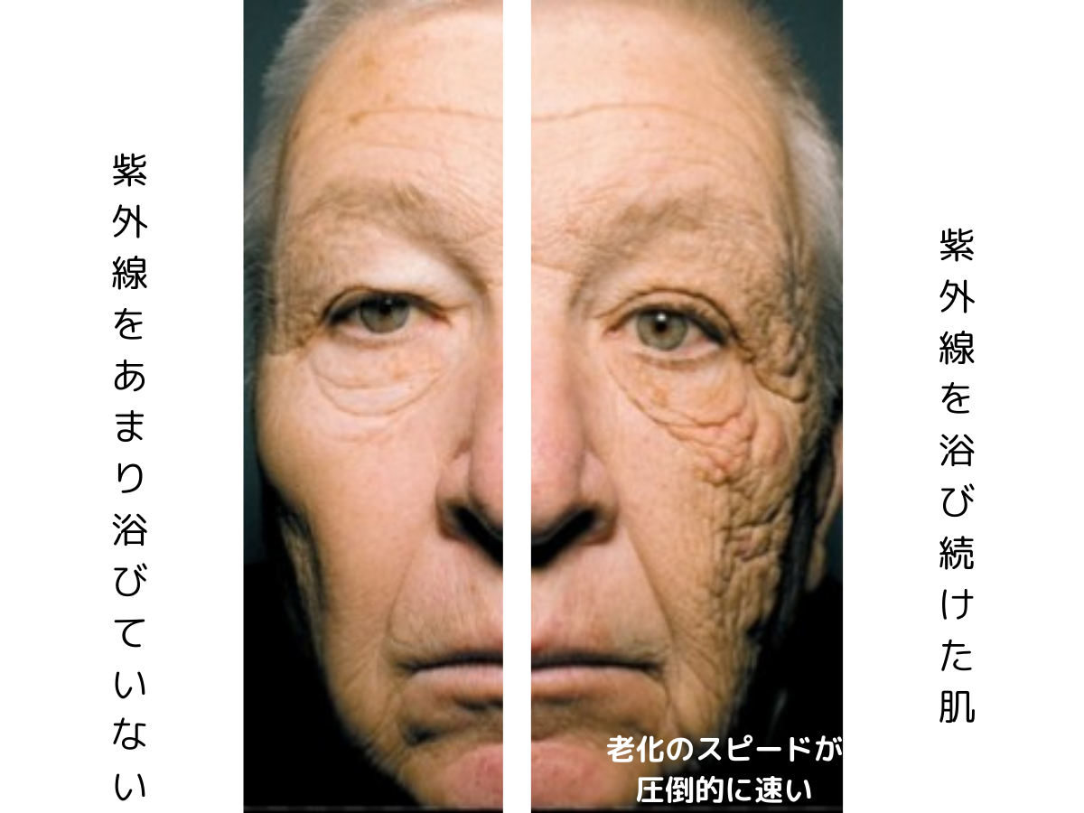 【実は老化の8割は紫外線⁉】
